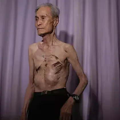 Sobrevivió a dos bombas atómicas en tres días: la increíble historia del hombre que estuvo en Hiroshima y Nagasaki
